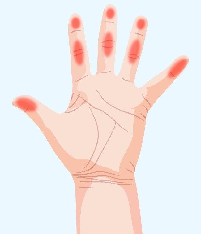 سوزن سوزن شدن دست‌ها؛ نشانه 7 تهدید مهم برای سلامت !