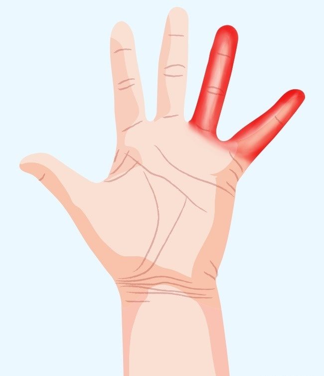 سوزن سوزن شدن دست‌ها؛ نشانه 7 تهدید مهم برای سلامت !
